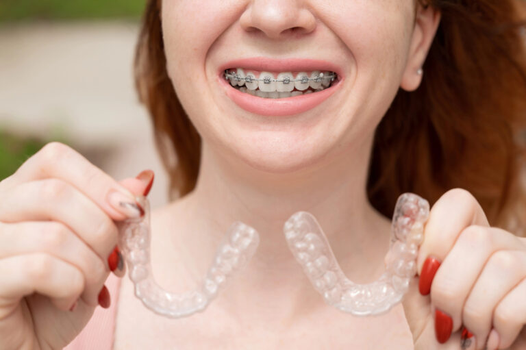Invisalign vs Traditional Braces